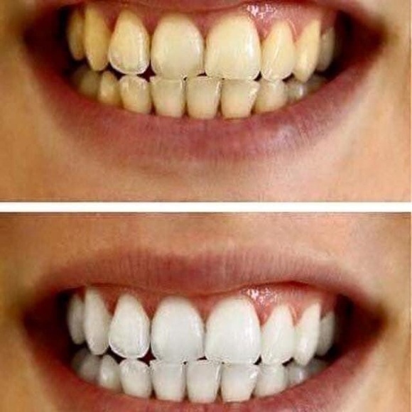 THE BEST Whitening Toothpaste!  NO HARSH CHEMICALS - Picture 9 of 12